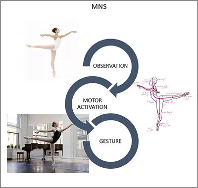 What Happens When I Watch a Ballet and I Am Dyskinetic? A fMRI Case Report in Parkinson Disease